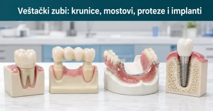 Slika za članak: Veštački zubi: krunice, mostovi, proteze i implanti